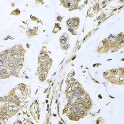 Anti-SBDS antibody used in IHC (Paraffin sections) (IHC-P). GTX64702