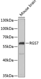 Anti-RGS7 antibody used in Western Blot (WB). GTX64703