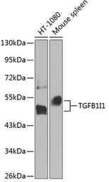 Anti-HIC5 antibody used in Western Blot (WB). GTX64707
