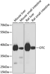 Anti-OTC antibody used in Western Blot (WB). GTX64710
