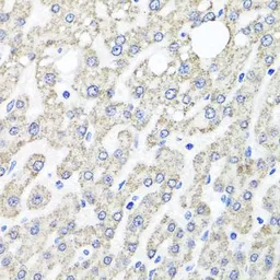 Anti-OTC antibody used in IHC (Paraffin sections) (IHC-P). GTX64710
