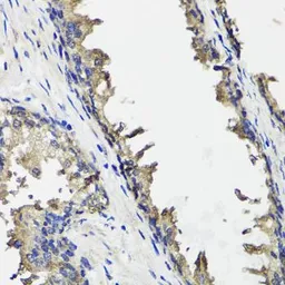 Anti-OTC antibody used in IHC (Paraffin sections) (IHC-P). GTX64710