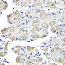 Anti-OTC antibody used in IHC (Paraffin sections) (IHC-P). GTX64710