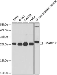 Anti-MAD2L2 antibody used in Western Blot (WB). GTX64711