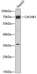 Anti-Cav beta 1 antibody used in Western Blot (WB). GTX64713