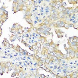 Anti-eIF3B antibody used in IHC (Paraffin sections) (IHC-P). GTX64714