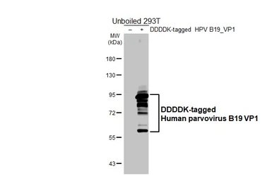 Anti-Human parvovirus B19 VP1 antibody [HL5828] used in Western Blot (WB). GTX647146
