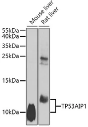 Anti-p53 AIP1 antibody used in Western Blot (WB). GTX64715