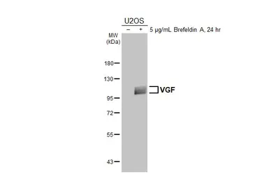 Anti-VGF antibody [HL5833] used in Western Blot (WB). GTX647151