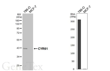 Anti-CYR61 antibody [HL5836] used in Western Blot (WB). GTX647154