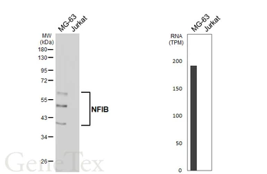 Anti-NFIB antibody [HL5837] used in Western Blot (WB). GTX647155