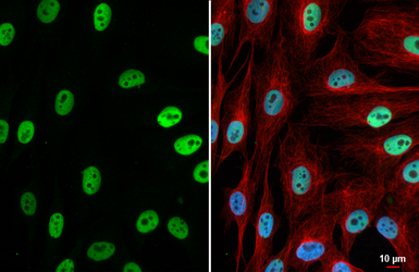 Anti-NFIB antibody [HL5837] used in Immunocytochemistry/ Immunofluorescence (ICC/IF). GTX647155