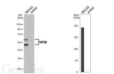 Anti-NFIB antibody [HL5837] used in Western Blot (WB). GTX647155