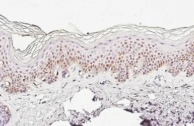 Anti-MITF antibody [HL5838] used in IHC (Paraffin sections) (IHC-P). GTX647156