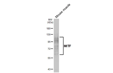 Anti-MITF antibody [HL5839] used in Western Blot (WB). GTX647157