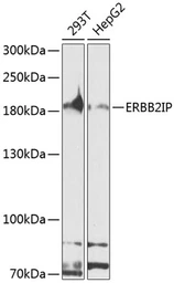 Anti-ERBIN antibody used in Western Blot (WB). GTX64716