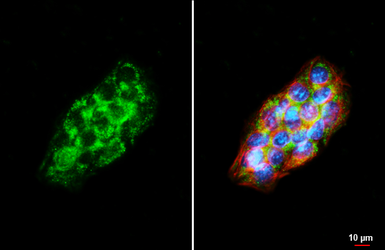 Anti-GPX1 antibody [HL5845] used in Immunocytochemistry/ Immunofluorescence (ICC/IF). GTX647163