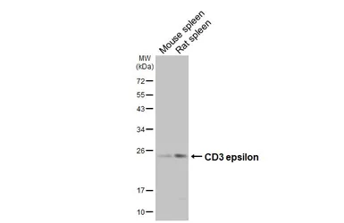 Anti-CD3 epsilon antibody [HL5848] used in Western Blot (WB). GTX647166