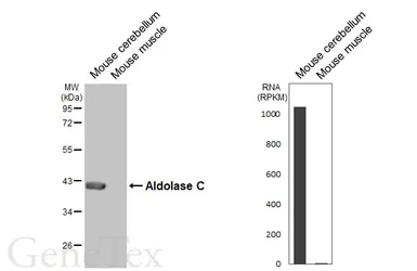 Anti-Aldolase C antibody [HL5849] used in Western Blot (WB). GTX647167