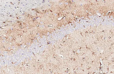 Anti-Aldolase C antibody [HL5849] used in IHC (Paraffin sections) (IHC-P). GTX647167
