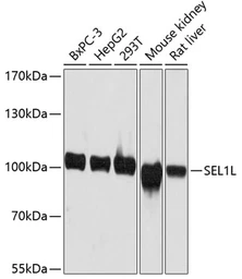 Anti-SEL1L antibody used in Western Blot (WB). GTX64717