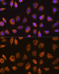 Anti-SEL1L antibody used in Immunocytochemistry/ Immunofluorescence (ICC/IF). GTX64717