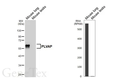 Anti-PLVAP antibody [HL5858] used in Western Blot (WB). GTX647176