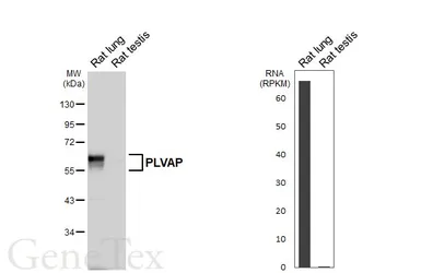 Anti-PLVAP antibody [HL5858] used in Western Blot (WB). GTX647176