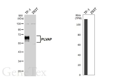 Anti-PLVAP antibody [HL5858] used in Western Blot (WB). GTX647176