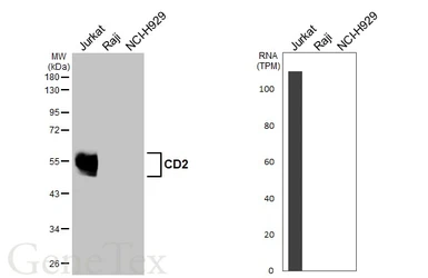 Anti-CD2 antibody [HL5859] used in Western Blot (WB). GTX647183