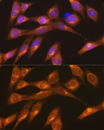 Anti-LMAN1 antibody used in Immunocytochemistry/ Immunofluorescence (ICC/IF). GTX64719