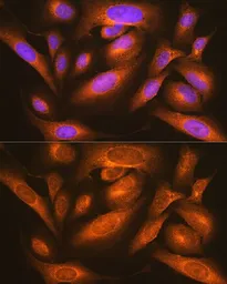 Anti-LMAN1 antibody used in Immunocytochemistry/ Immunofluorescence (ICC/IF). GTX64719