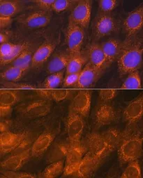 Anti-LMAN1 antibody used in Immunocytochemistry/ Immunofluorescence (ICC/IF). GTX64719