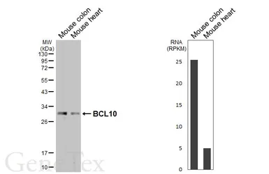 Anti-BCL10 antibody [HL5868] used in Western Blot (WB). GTX647192