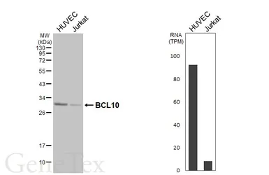 Anti-BCL10 antibody [HL5868] used in Western Blot (WB). GTX647192