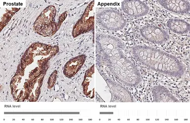 Anti-CD9 antibody [HL5878] used in IHC (Paraffin sections) (IHC-P). GTX647202