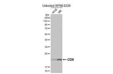 Anti-CD9 antibody [HL5880] used in Western Blot (WB). GTX647204