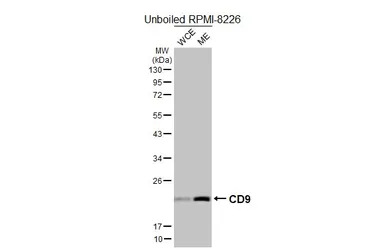 Anti-CD9 antibody [HL5882] used in Western Blot (WB). GTX647206