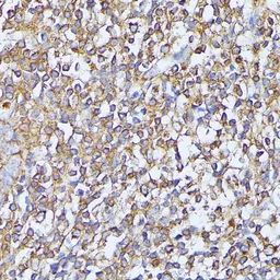 Anti-MST3 antibody used in IHC (Paraffin sections) (IHC-P). GTX64721