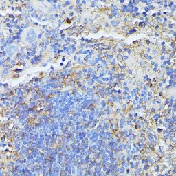 Anti-MST3 antibody used in IHC (Paraffin sections) (IHC-P). GTX64721
