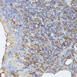 Anti-MST3 antibody used in IHC (Paraffin sections) (IHC-P). GTX64721