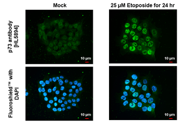 Anti-p73 antibody [HL5894] used in Immunocytochemistry/ Immunofluorescence (ICC/IF). GTX647218