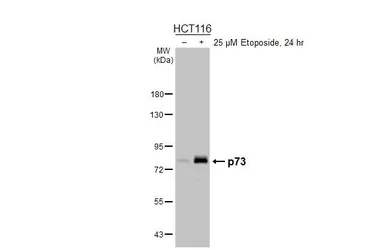 Anti-p73 antibody [HL5895] used in Western Blot (WB). GTX647219