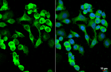 Anti-S100A9 antibody [HL5896] used in Immunocytochemistry/ Immunofluorescence (ICC/IF). GTX647220