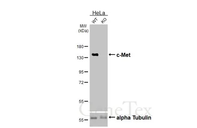 Anti-c-Met antibody [HL5899] used in Western Blot (WB). GTX647223
