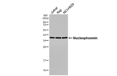 Anti-Nucleophosmin antibody [HL5905] used in Western Blot (WB). GTX647229