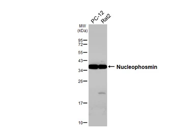 Anti-Nucleophosmin antibody [HL5905] used in Western Blot (WB). GTX647229