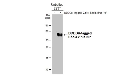 Anti-Ebola virus NP antibody [GT390] used in Western Blot (WB). GTX647231
