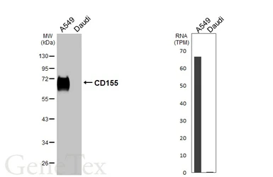 Anti-CD155 antibody [HL5911] used in Western Blot (WB). GTX647236