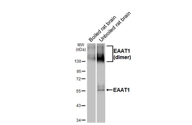 Anti-EAAT1 antibody [HL5912] used in Western Blot (WB). GTX647237